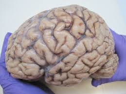 Illustrative brain anatomy gradient placeholder